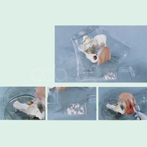 Transparent Curettage Model(medical model)
