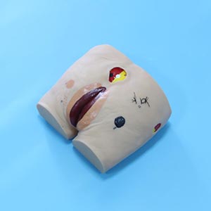 <a href=''><span style='color:#2f82c5; display:inline; font-weight:bold;'>Advanced bedsore Care model</span></a>